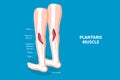 3D Isometric Flat Vector Conceptual Illustration of Plantaris Muscle