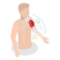 3D Isometric Flat Vector Illustration of Anatomical Contracted And Relaxed Arm Muscular. Item 2