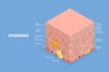 3D Isometric Flat Vector Illustration of Epidermis Anatomy Royalty Free Stock Photo
