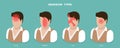 3D Isometric Flat Vector Illustration of Headache Types Royalty Free Stock Photo