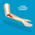 3D Isometric Flat Vector Illustration of Ulnar Collateral Ligament Royalty Free Stock Photo