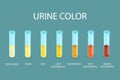 3D Isometric Flat Vector Illustration of Urine Color Chart Royalty Free Stock Photo