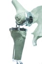 3D knee prosthesis for medicine Royalty Free Stock Photo