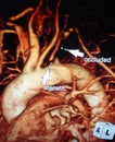 3D magnetic resonance angiography pathology