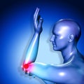 3d medical figure having pain in injured elbow