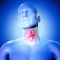 3d medical figure with virus cells on sore throat
