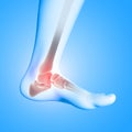 3D medical image of ankle bone