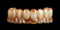 3D realistic yellow damaged human molars on a black background with copy space. Healthy teeth concept.