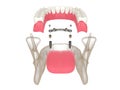 3d render of bar retained removable overdenture installation supported by two implants Royalty Free Stock Photo
