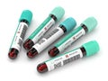 3d render of blood samples with hepatitis test