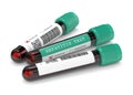 3d render of  blood samples with hepatitis test Royalty Free Stock Photo