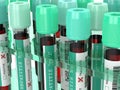 3d render of  blood samples with hepatitis test Royalty Free Stock Photo