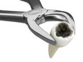 3d render of dental forceps extracting tooth with caries