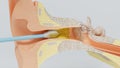 3d render ear cleansing earwax ear stick. 3d illustration Royalty Free Stock Photo