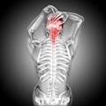 3D render of a female figure with head and neck pain Royalty Free Stock Photo