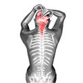 3D render of a female figure with head and neck pain Royalty Free Stock Photo