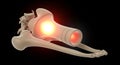 3D render of human leg bones with glowing red inflammation in joints pain Royalty Free Stock Photo