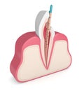 3d render of incisor tooth with gutta percha Royalty Free Stock Photo