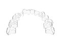 3d render of invisalign removable aligner