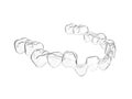 3d render of invisalign removable aligner