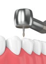 3d render of jaw with dental handpiece and drill Royalty Free Stock Photo