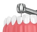 3d render of jaw with dental handpiece and drill Royalty Free Stock Photo