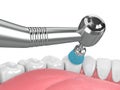 3d render of jaw with dental handpiece and polishing brush Royalty Free Stock Photo