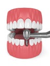 3d render of jaw with dental implant drill Royalty Free Stock Photo