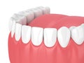 3d render of jaw model with teeth over white Royalty Free Stock Photo