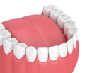 3d render of jaw model with teeth over white Royalty Free Stock Photo