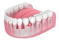 3d render of jaw and teeth with cyst Royalty Free Stock Photo