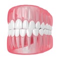 3d render of jaw with teeth over white Royalty Free Stock Photo