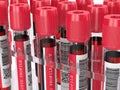 3d render with lipid profile test blood samples Royalty Free Stock Photo