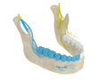 3d render of mandibular arch with gow-gates nerve block