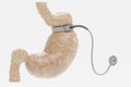 3D Render of Stomach with Gastric Band