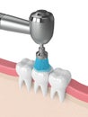 3d render of teeth with dental handpiece and polishing brush Royalty Free Stock Photo