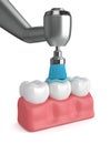 3d render of teeth with dental handpiece and polishing brush Royalty Free Stock Photo