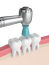 3d render of teeth with dental handpiece and polishing brush Royalty Free Stock Photo