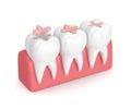 3d render of teeth with dental inlay filling Royalty Free Stock Photo