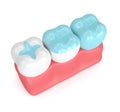 3d render of teeth with different types of filling