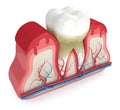 3d render of tooth in bleeding gums