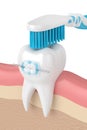 3d render of tooth with braces and toothbrush