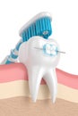 3d render of tooth with braces and toothbrush