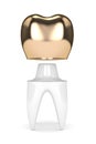 3d render of tooth with dental golden crown filling