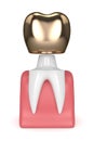 3d render of tooth dental golden crown filling