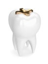 3d render of tooth with dental golden inlay filling