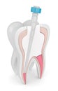 3d render of tooth with gutta percha, fiber post and filling Royalty Free Stock Photo