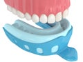 3d render of upper jaw with dental impression tray