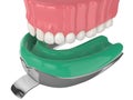 3d render of upper jaw with dental impression tray