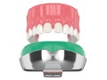 3d render of upper jaw with dental impression tray